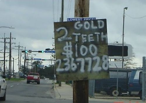 Cost of Teeth Dental Gold Restorations - New Orleans, LA. Cost of Teeth Dental   Gold Restorations - New Orleans, LA.. Dental Procedures Cost New Orleans, 