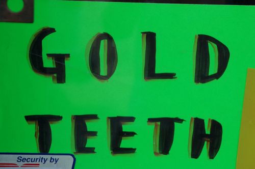 23 Feb 2011  Walter Davis may have been saved by the shiny, gold skin of his tooth. Davis was   shot this month during an argument with his younger brother 