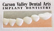 Carson Valley Dental Arts